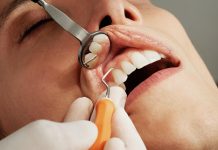 Urgence dentaire Rouen